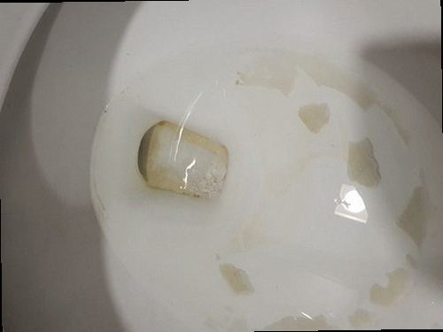 부산 남구 용호3동 하수구막힘 배수구 주변의 물 고임과 오염 상태를 확인하는 모습